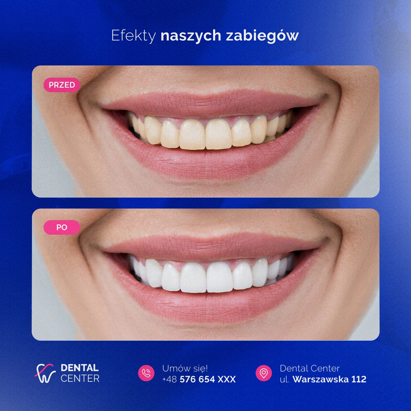 PREZENTACJA_DENTAL_CENTER_SOCIAL_MEDIA_5-min